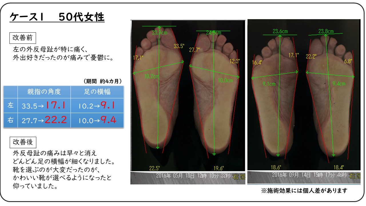 神戸フットケア