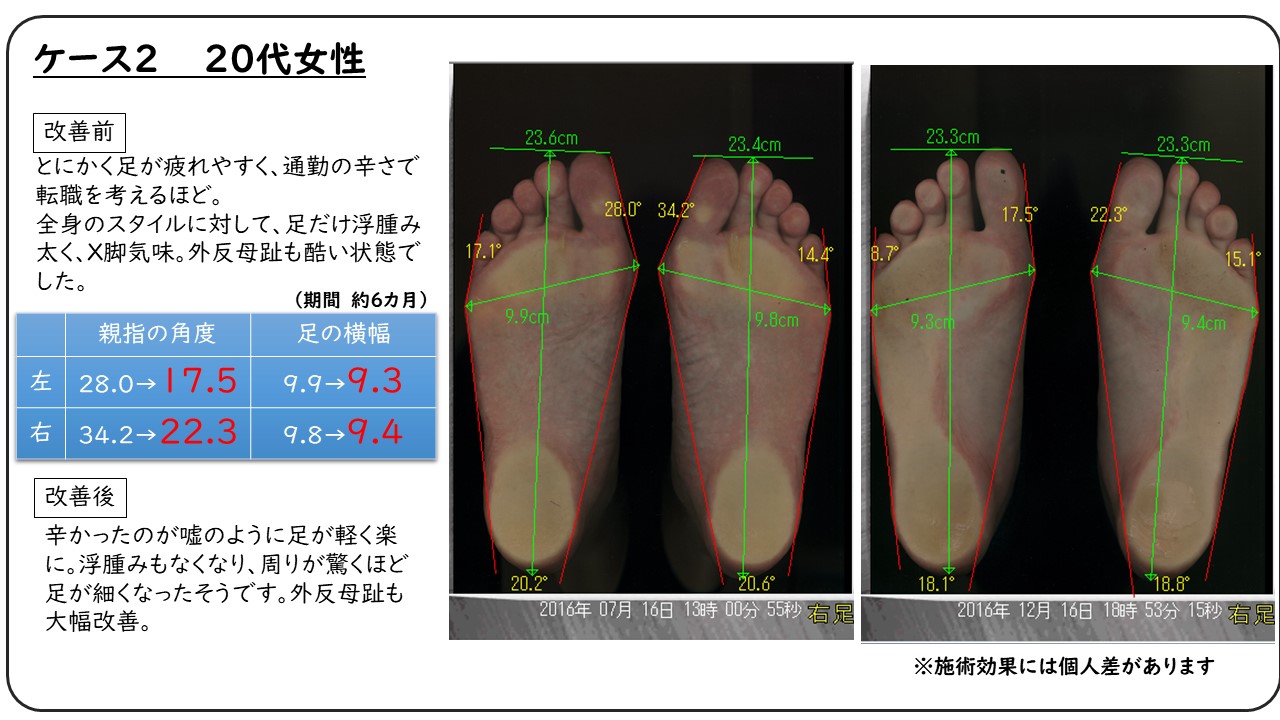 神戸フットケア